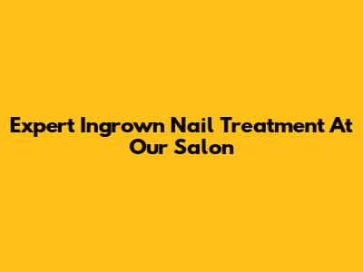 Expert Ingrown Nail Treatment At Our Salon