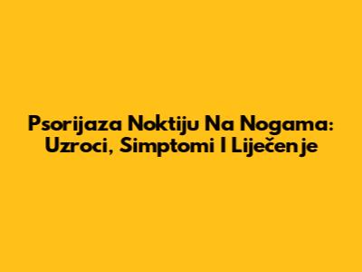 Psorijaza Noktiju Na Nogama: Uzroci, Simptomi I Liječenje