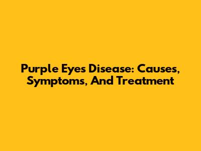 Purple Eyes Disease: Causes, Symptoms, And Treatment