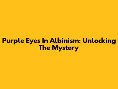 Purple Eyes In Albinism: Unlocking The Mystery