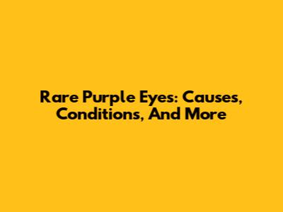 Rare Purple Eyes: Causes, Conditions, And More