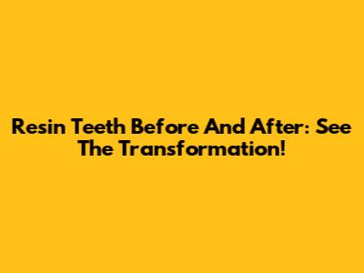 Resin Teeth Before And After: See The Transformation!