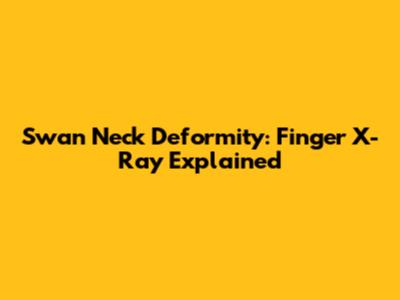 Swan Neck Deformity: Finger X-Ray Explained