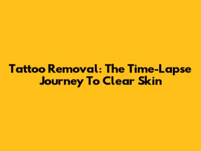 Tattoo Removal: The Time-Lapse Journey To Clear Skin