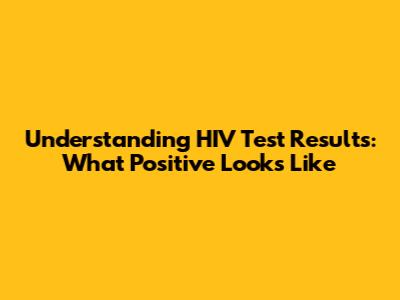 Understanding HIV Test Results: What Positive Looks Like